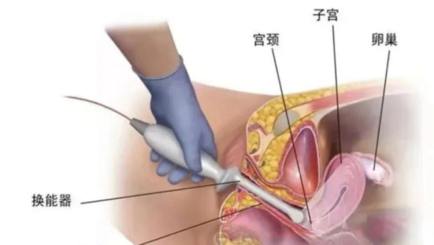 澳门管家婆三肖三码100%中,误触考上了研究生怎么办,精准解释落实及其象征意义_枚举版V3.4